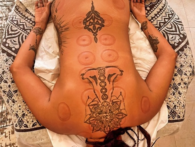 Relaxed client after cupping therapy